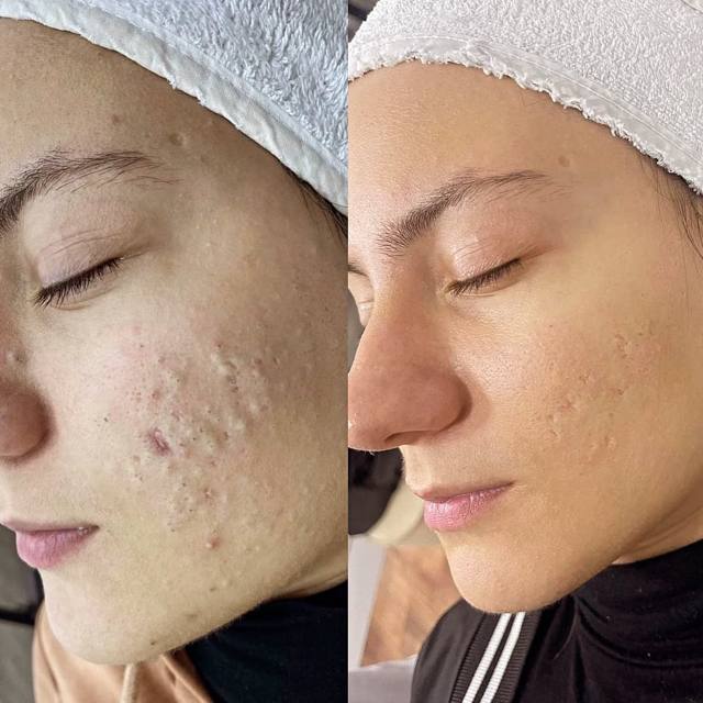Sidre Beauty çalışmalarından bir kare.