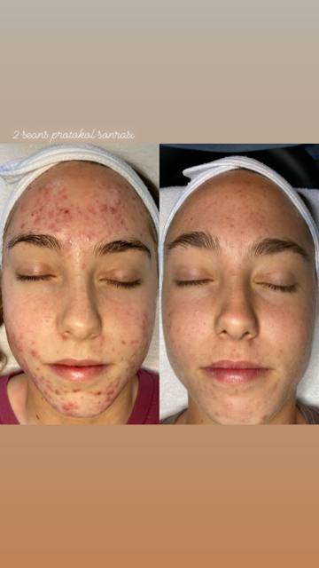 Sidre Beauty çalışmalarından bir kare.