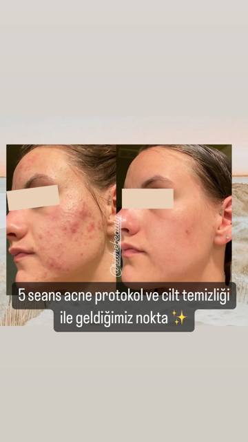 Sidre Beauty çalışmalarından bir kare.